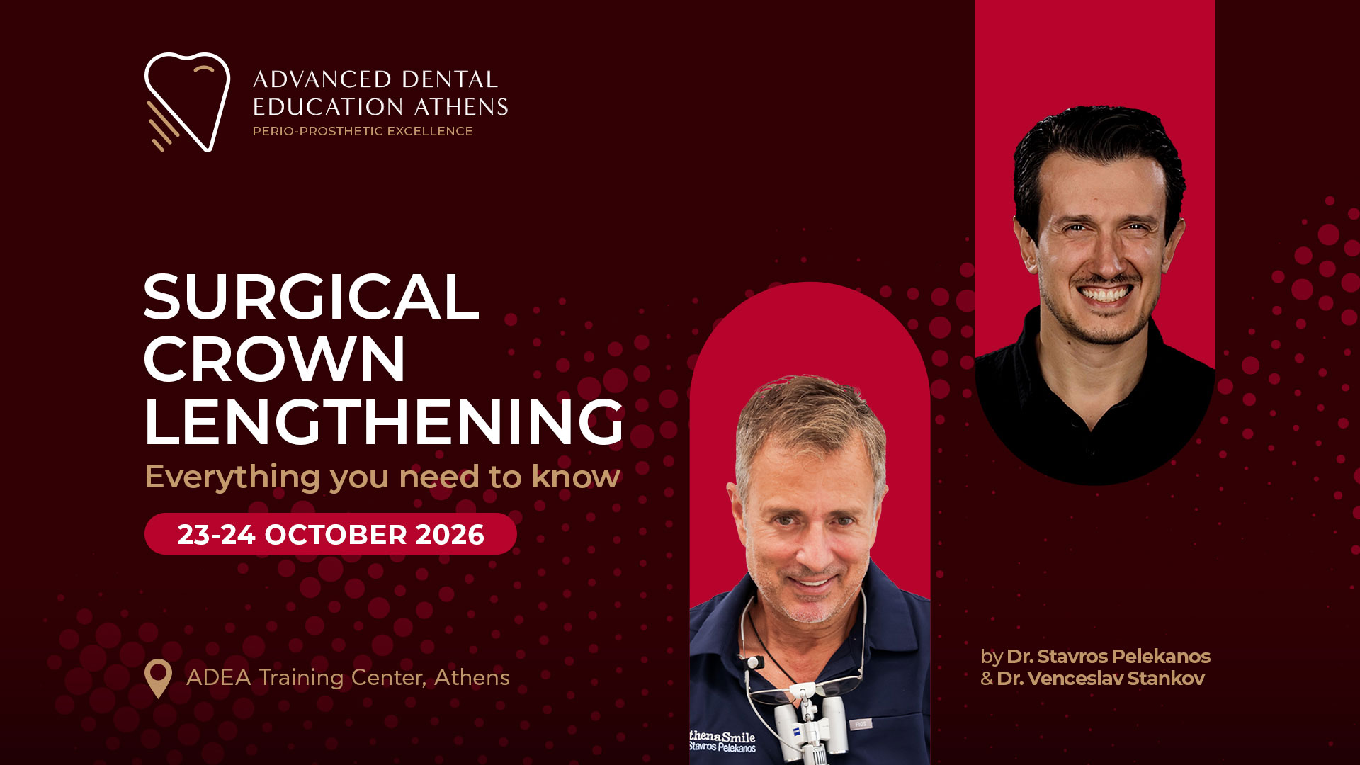 Surgical Crown Lengthening. Everything you need to know.